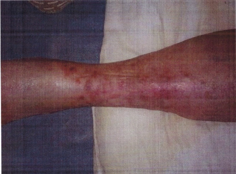 before-and-after-1-2-e1428100860642